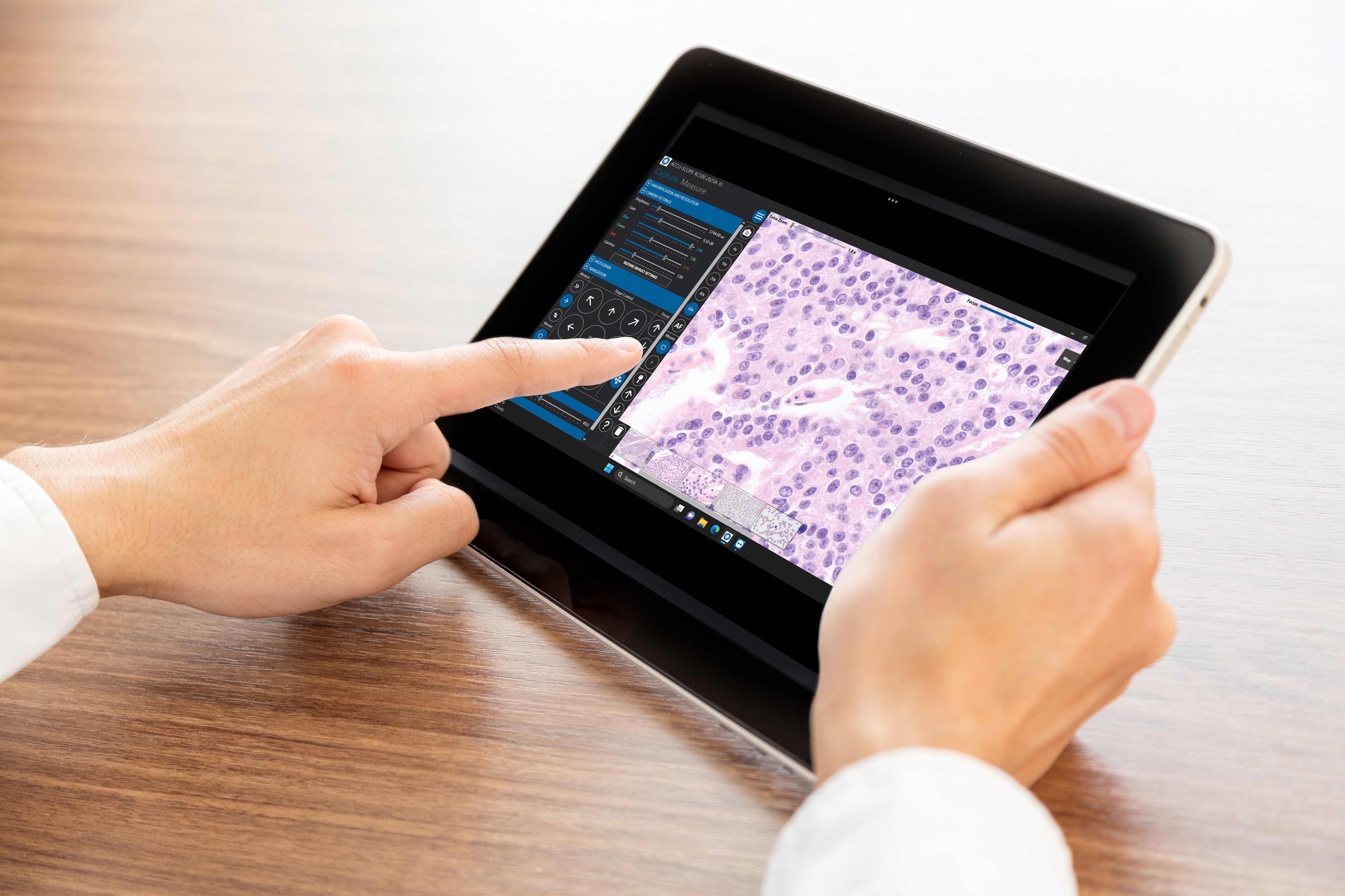 Telepathology using mobile device or tablet
