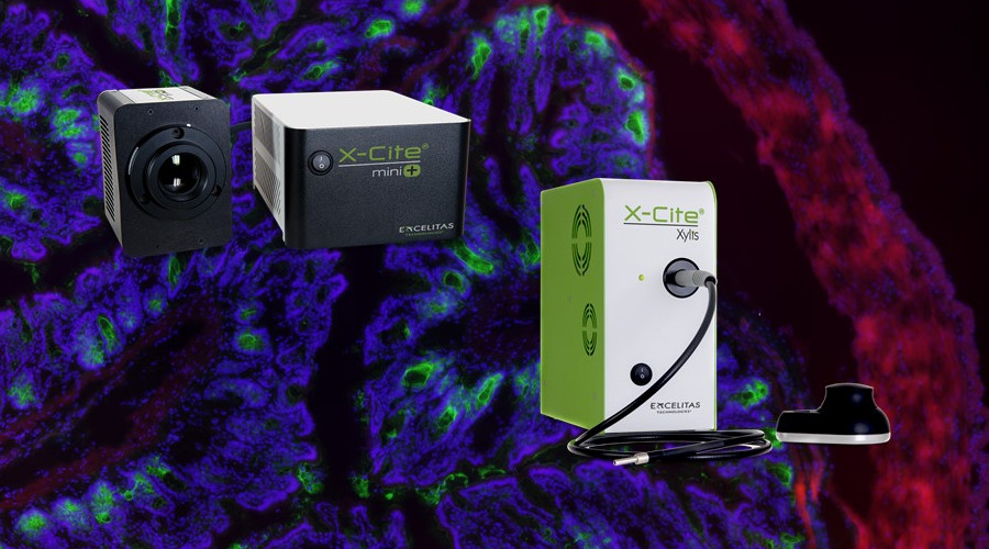 ACCU-SCOPE becomes Master Distributor for X-Cite