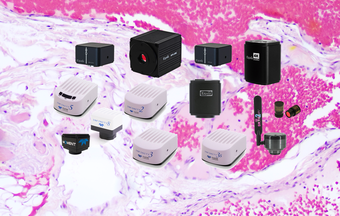 Top Considerations When Buying A Microscopy Camera, PART 8:  Controlling Your Camera (software)
